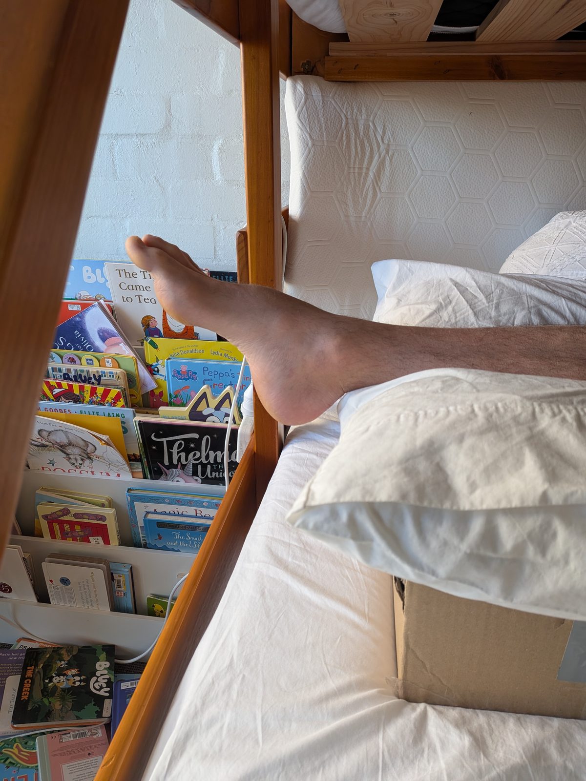 Leg elevated on pillows in the early days of Achilles tendon rupture recovery